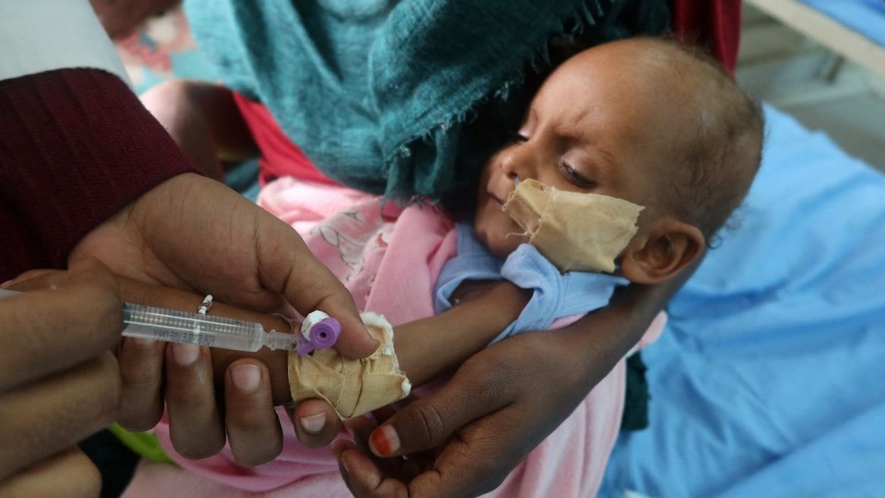 A child, suffering from malnutrition, is treated at Port Sudan Paediatric Centre, during a visit by WHO Director-General Tedros Adhanom Ghebreyesus to the country, in Sudan, on Sept. 7, 2024.