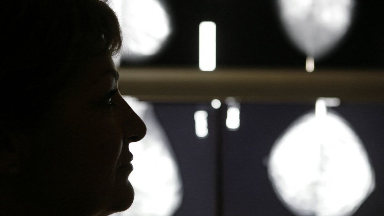 FILE PHOTO: Vasiliki Kostoula, a Greek breast cancer patient, listens to her doctor after a radiological medical examination in an Athens hospital October 29, 2008.