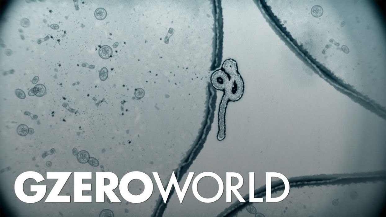 Lessons learned from the AIDS epidemic