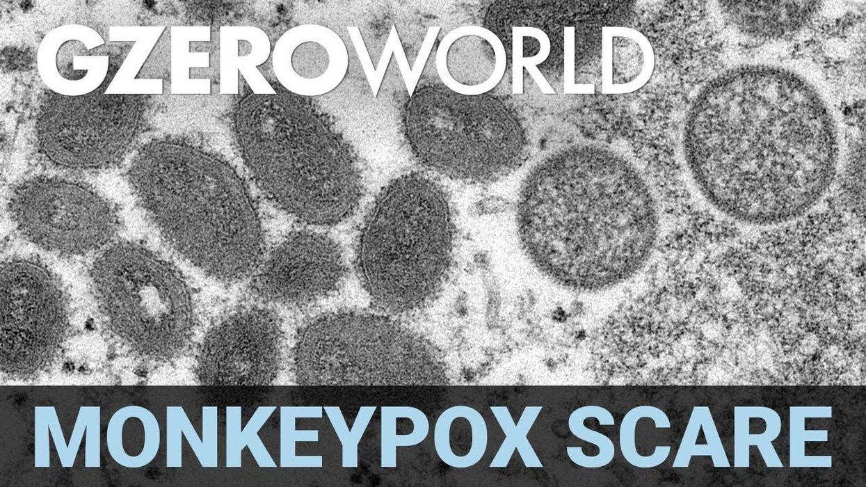 Should we worry about monkeypox?